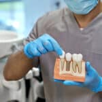 Dental professional holding teeth model for dental implant surgery.