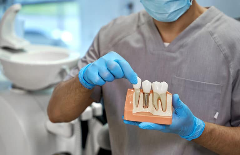 Dental professional holding teeth model for dental implant surgery.