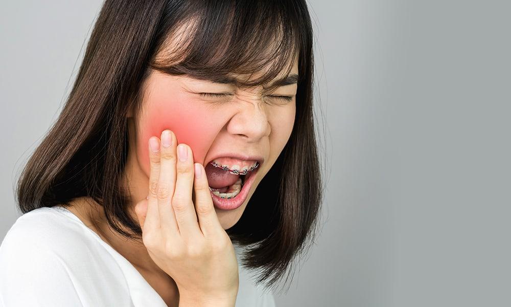 Woman with braces touching sore cheeks in pain due to cracked tooth.