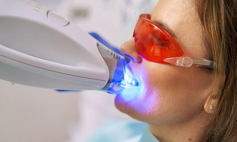 Patient with special blue light over teeth for teeth whitening procedure.