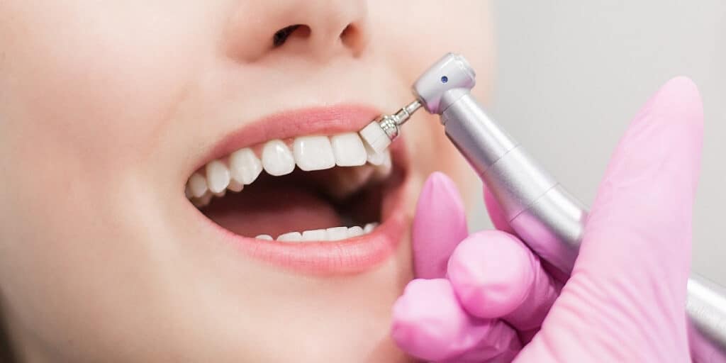 Tooth whitening procedure in North York office