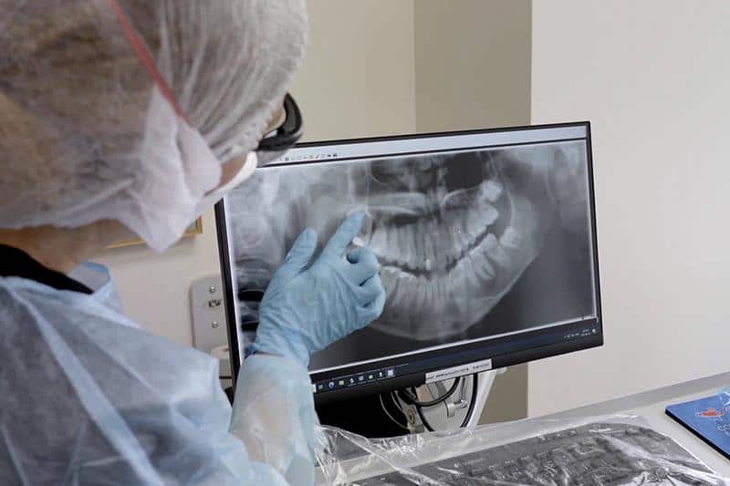 Dentist in PPE pointing at digital dental X-ray image result