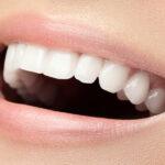 Cosmetic dentistry in North York